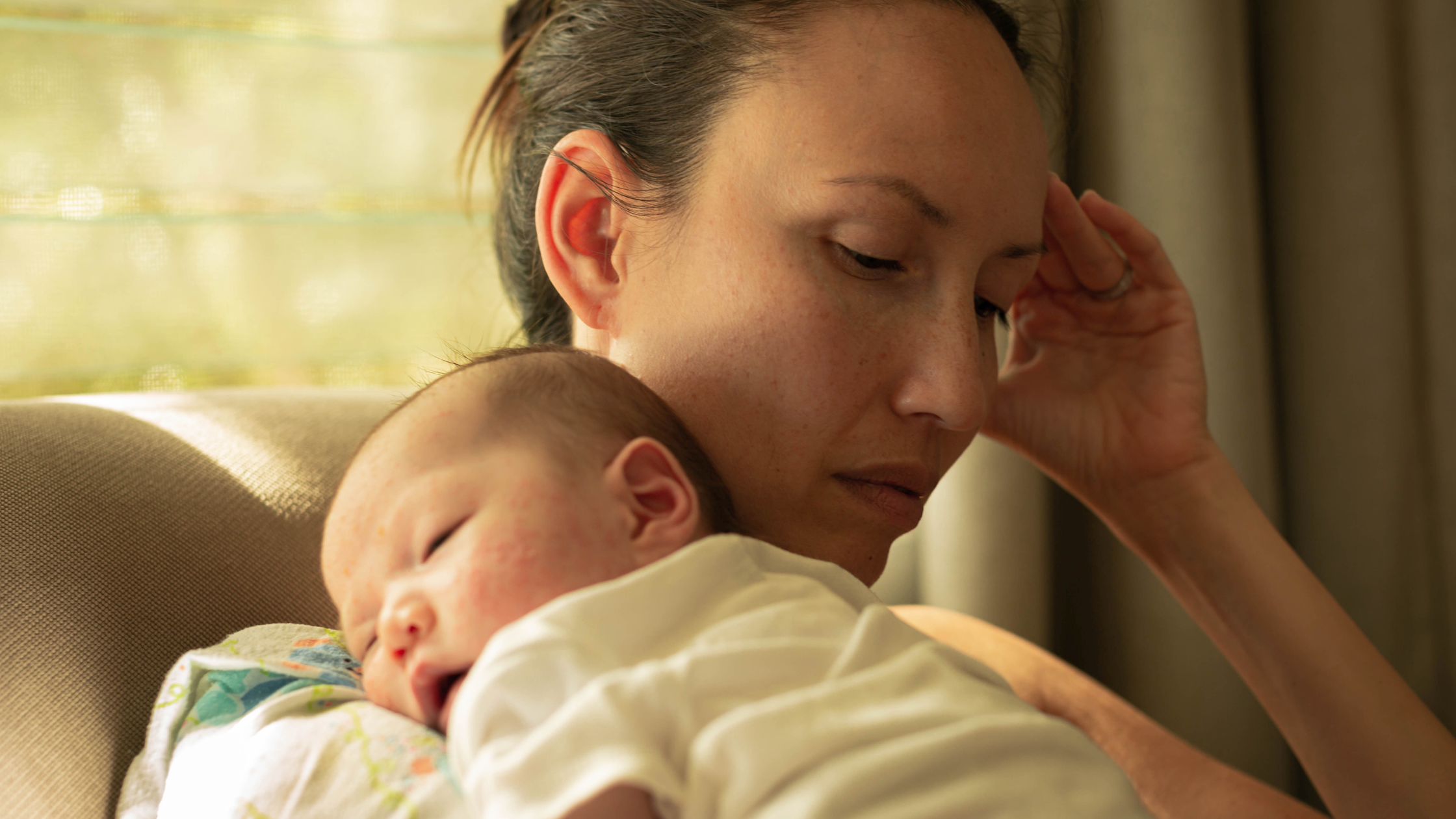 Postpartum Hair Loss and Its Relationship with Telogen Effluvium