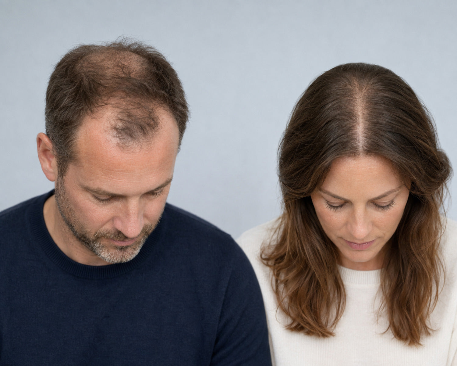 Man en vrouw met typische patronen van androgenetische haarverdunning