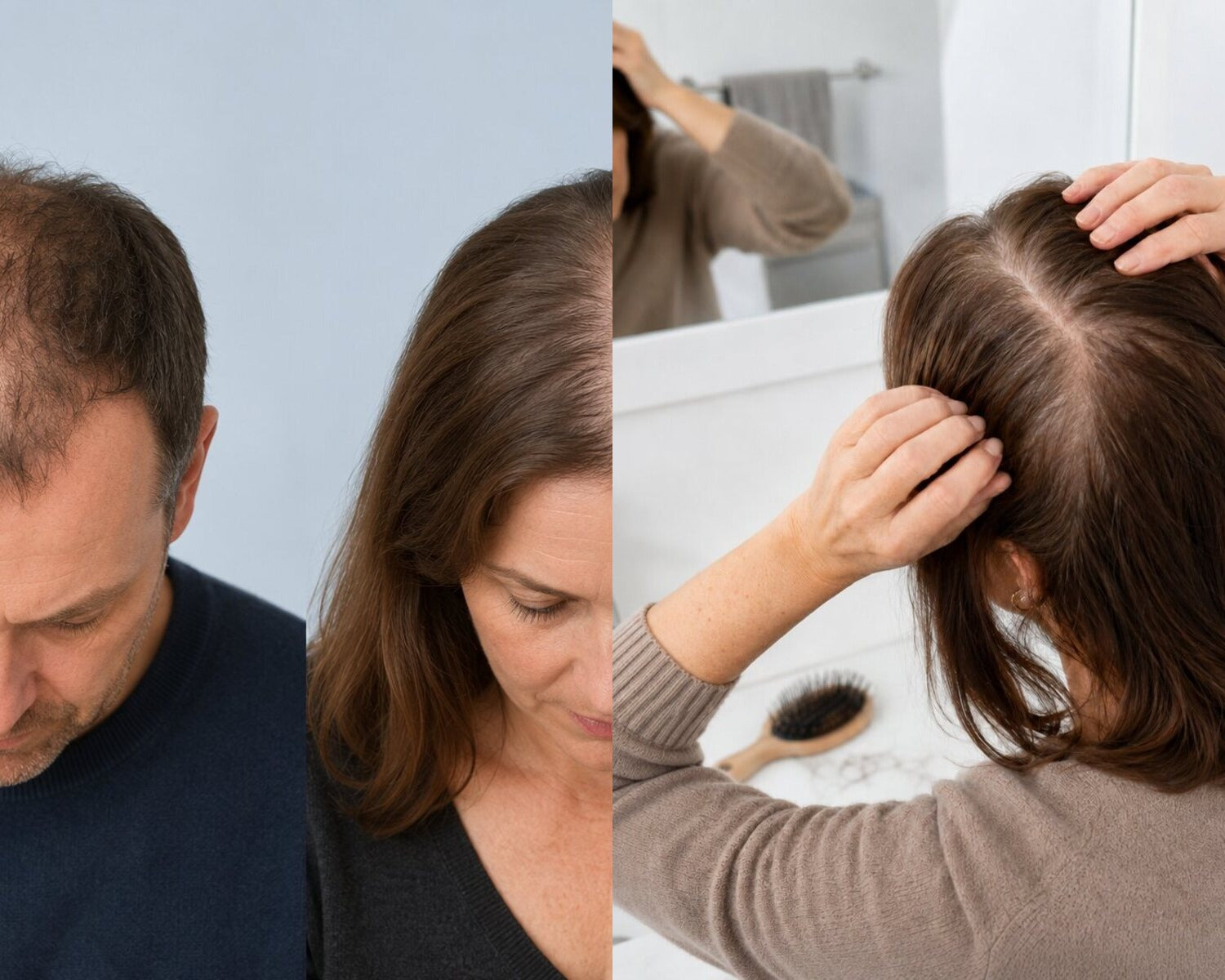 Vergelijking tussen patroongebonden haarverdunning en diffuse haaruitval