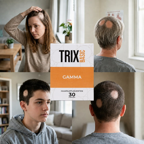 TRIX Basic Gamma bij plaatselijke kale plekken passend bij alopecia areata bij mannen en vrouwen.